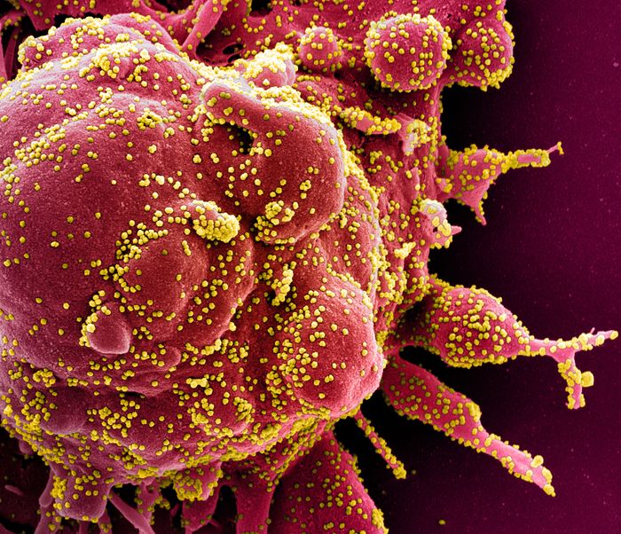 Colorized scanning electron micrograph of an apoptotic cell (red) heavily infected with SARS-COV-2 virus particles (yellow), isolated from a patient sample. Image captured at the NIAID Integrated Research Facility (IRF) in Fort Detrick, Maryland. / Credit: NIAID
