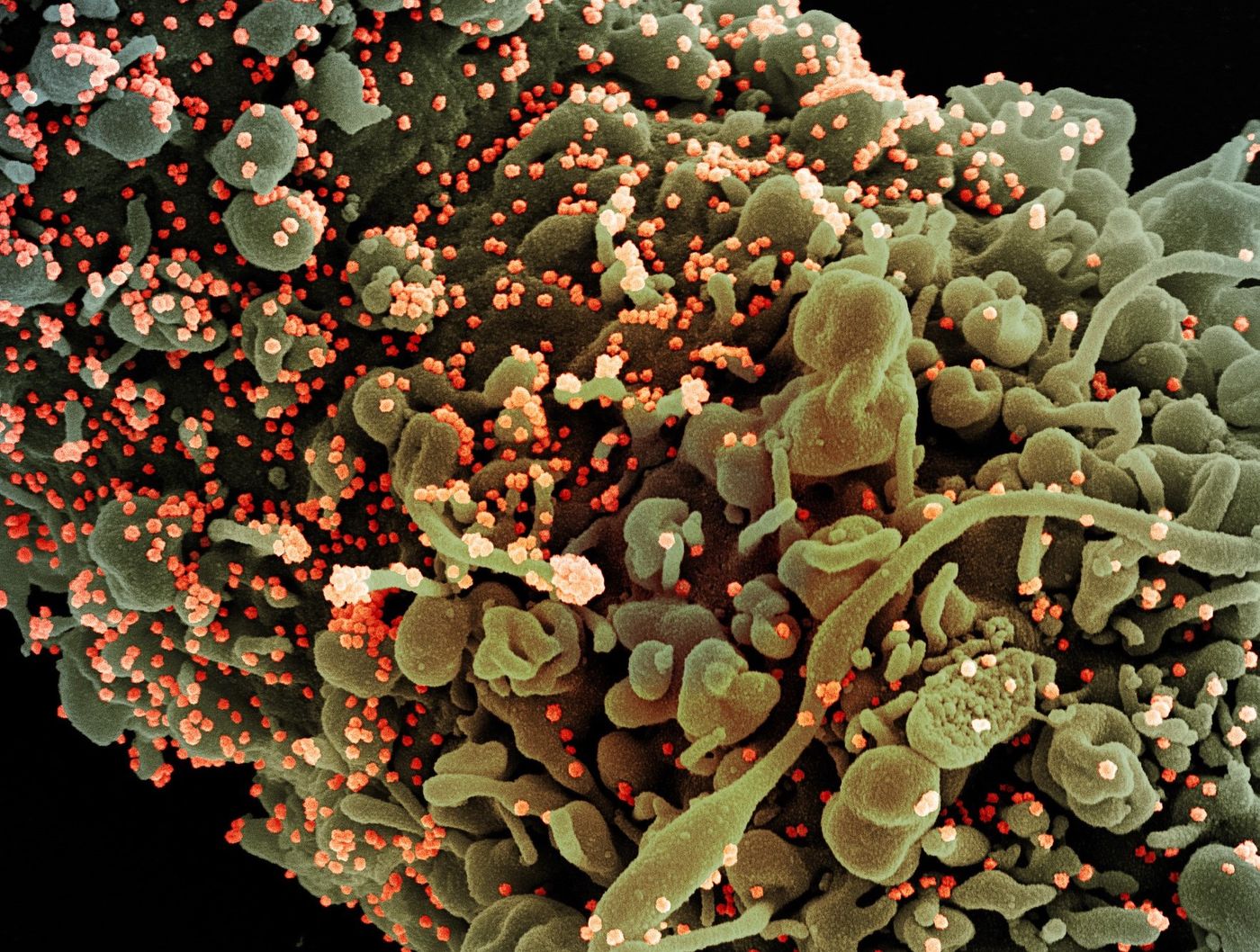 Colorized scanning electron micrograph of a cell showing morphological signs of apoptosis, infected with SARS-COV-2 virus particles (orange), isolated from a patient sample. Image captured at the NIAID Integrated Research Facility (IRF) in Fort Detrick, Maryland. / Credit: NIAID