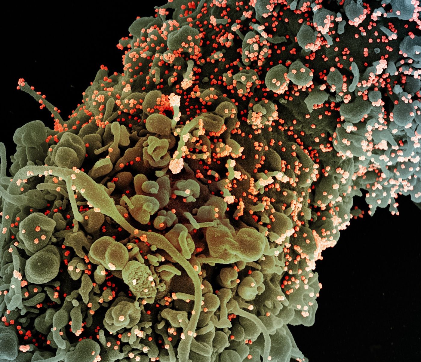 Colorized scanning electron micrograph of a cell showing morphological signs of apoptosis, infected with SARS-COV-2 virus particles (orange), isolated from a patient sample. Image captured at the NIAID Integrated Research Facility (IRF) in Fort Detrick, Maryland. / Credit: NIAID
