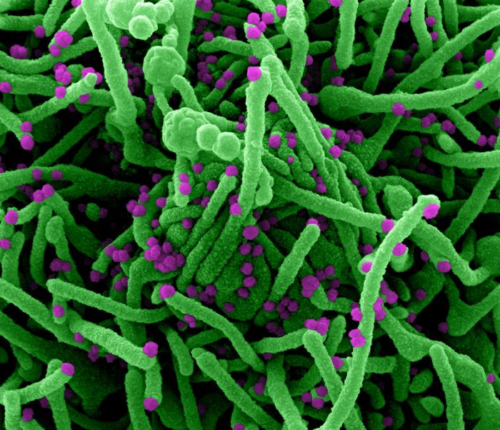 Colorized scanning electron micrograph of a cell (green) infected with SARS-CoV-2 virus particles (purple), isolated from a patient sample. Image captured at the NIAID Integrated Research Facility (IRF) in Fort Detrick, Maryland. / Credit: NIAID