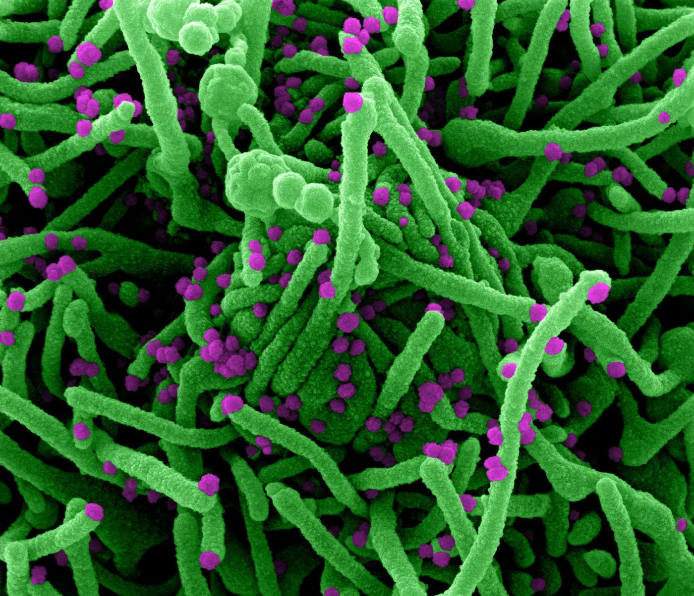 Colorized scanning electron micrograph of a cell (green) infected with SARS-COV-2 virus particles (purple), isolated from a patient sample. Image captured at the NIAID Integrated Research Facility (IRF) in Fort Detrick, Maryland. / Credit: NIAID