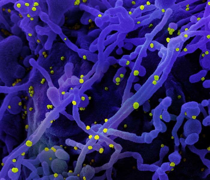 Colorized scanning electron micrograph of a cell (purple) infected with SARS-CoV-2 virus particles (yellow), isolated from a patient sample. Image captured at the NIAID Integrated Research Facility (IRF) in Fort Detrick, Maryland. / Credit: NIAID