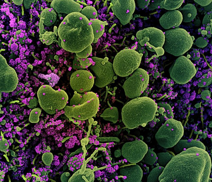 Colorized scanning electron micrograph of an apoptotic cell (green) heavily infected with SARS-CoV-2 virus particles (purple), isolated from a patient sample. Image captured at the NIAID Integrated Research Facility (IRF) in Fort Detrick, Maryland. / Credit: NIAID