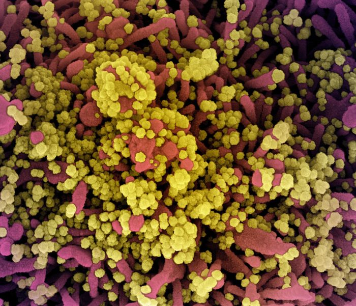 Colorized scanning electron micrograph of a cell heavily infected with SARS-CoV-2 virus particles (yellow), isolated from a patient sample. Image captured at the NIAID Integrated Research Facility (IRF) in Fort Detrick, Maryland. / Credit: NIAID