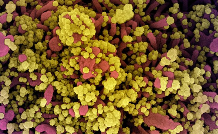   Colorized scanning electron micrograph of a cell heavily infected with SARS-CoV-2 virus particles (yellow), isolated from a patient sample. Image captured at the NIAID Integrated Research Facility (IRF) in Fort Detrick, Maryland. / Credit: NIAID