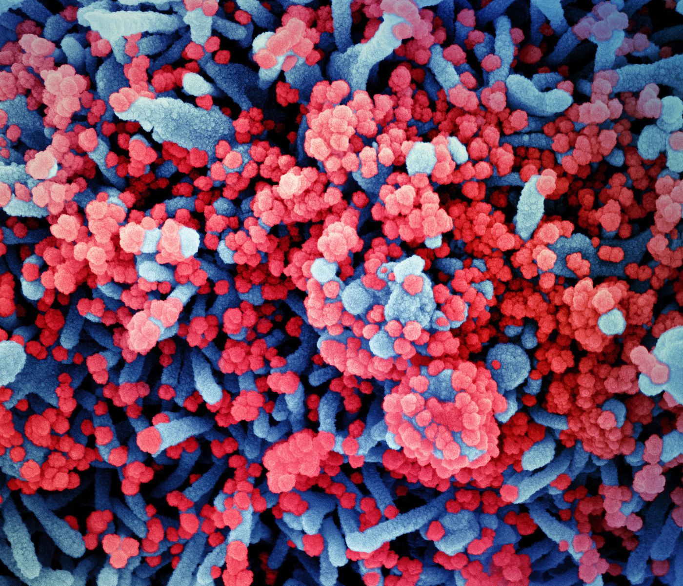 Colorized scanning electron micrograph of a cell (blue) heavily infected with SARS-CoV-2 virus particles (red), isolated from a patient sample. Image captured at the NIAID Integrated Research Facility (IRF) in Fort Detrick, Maryland. / Credit: NIAID