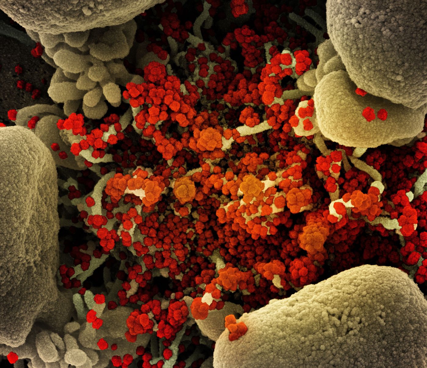 Colorized scanning electron micrograph of an apoptotic cell (tan) heavily infected with SARS-CoV-2 virus particles (orange), isolated from a patient sample. Image captured at the NIAID Integrated Research Facility (IRF) in Fort Detrick, Maryland. / Credit: NIAID