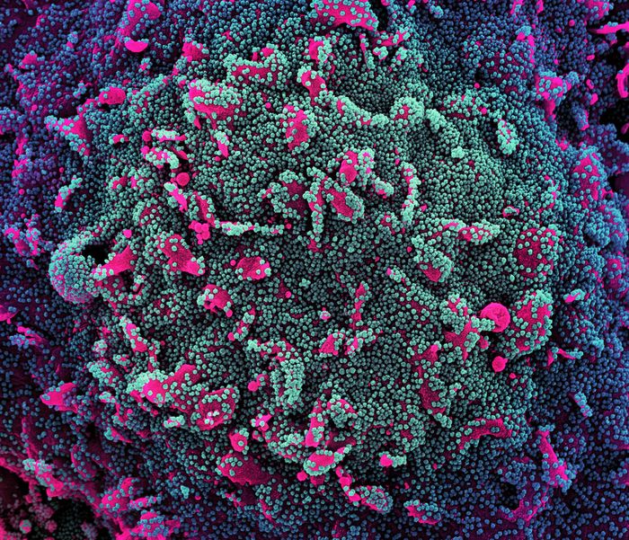 Colorized scanning electron micrograph of a cell (pink) heavily infected with SARS-CoV-2 virus particles (teal and purple), isolated from a patient sample. Image captured at the NIAID Integrated Research Facility (IRF) in Fort Detrick, Maryland. Credit: NIAID 