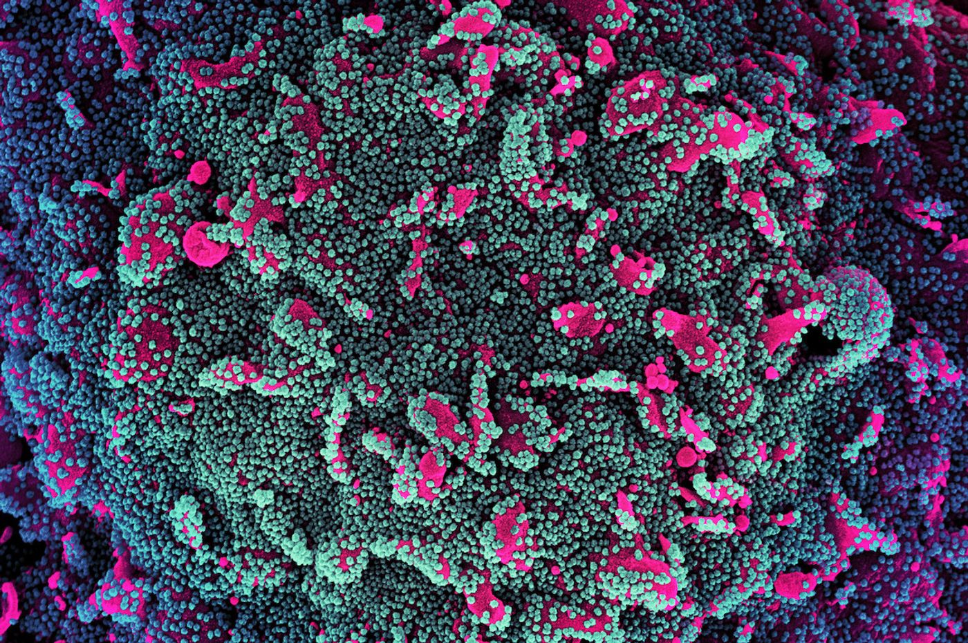 (Cropped from a) Colorized scanning electron micrograph of a cell (pink) heavily infected with SARS-CoV-2 virus particles (teal and purple), isolated from a patient sample. Image captured at the NIAID Integrated Research Facility (IRF) in Fort Detrick, Maryland. / Credit: NIAID 