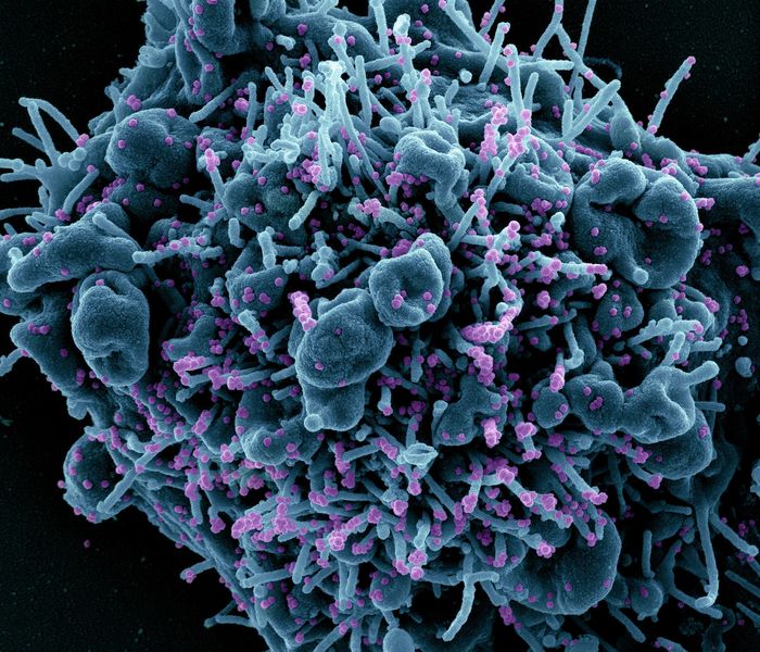 Colorized scanning electron micrograph of an apoptotic cell (teal) infected with SARS-COV-2 virus particles (purple), isolated from a patient sample. Image captured at the NIAID Integrated Research Facility (IRF) in Fort Detrick, Maryland. Credit: NIAID