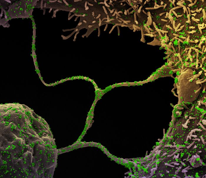 Colorized scanning electron micrograph of CCL-81 Cells infected with SARS-CoV-2 virus particles (green), isolated from a patient sample. The tentacle-like protrusions from the cells are filapodia, which extend from infected cells, attach to neighboring cells, and promote viral infection as a transport system for virus particles. Image captured at the NIAID Integrated Research Facility (IRF) in Fort Detrick, Maryland. Credit: NIAID