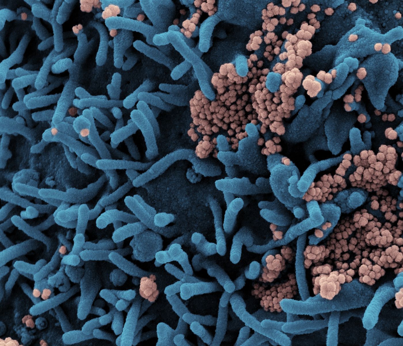 Colorized scanning electron micrograph of a cell (blue) infected with SARS-CoV-2 virus particles (pink), isolated from a patient sample. Image captured at the NIAID Integrated Research Facility (IRF) in Fort Detrick, Maryland. Credit: NIAID