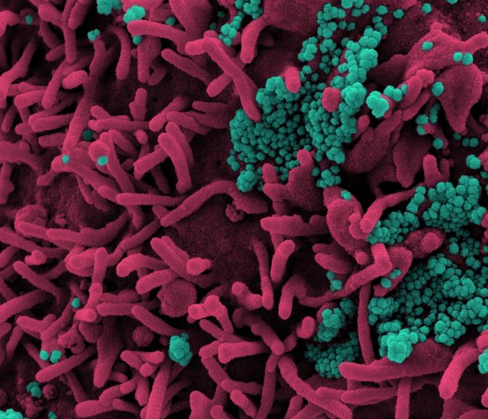 Colorized scanning electron micrograph of a cell (pink) infected with SARS-CoV-2 virus particles (teal), isolated from a patient sample. Image captured at the NIAID Integrated Research Facility (IRF) in Fort Detrick, Maryland. Credit: NIAID