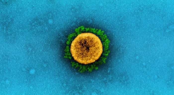 (Cropped) Transmission electron micrograph of a SARS-CoV-2 virus particle , isolated from a patient sample and cultivated in cell culture. The prominent projections (green) seen on the outside of the virus particle (yellow) are spike proteins. This fringe of proteins enables the virus to attach to and infect host cells and then replicate. Image captured at the NIAID Integrated Research Facility (IRF) in Fort Detrick, Maryland. / Credit: NIAID