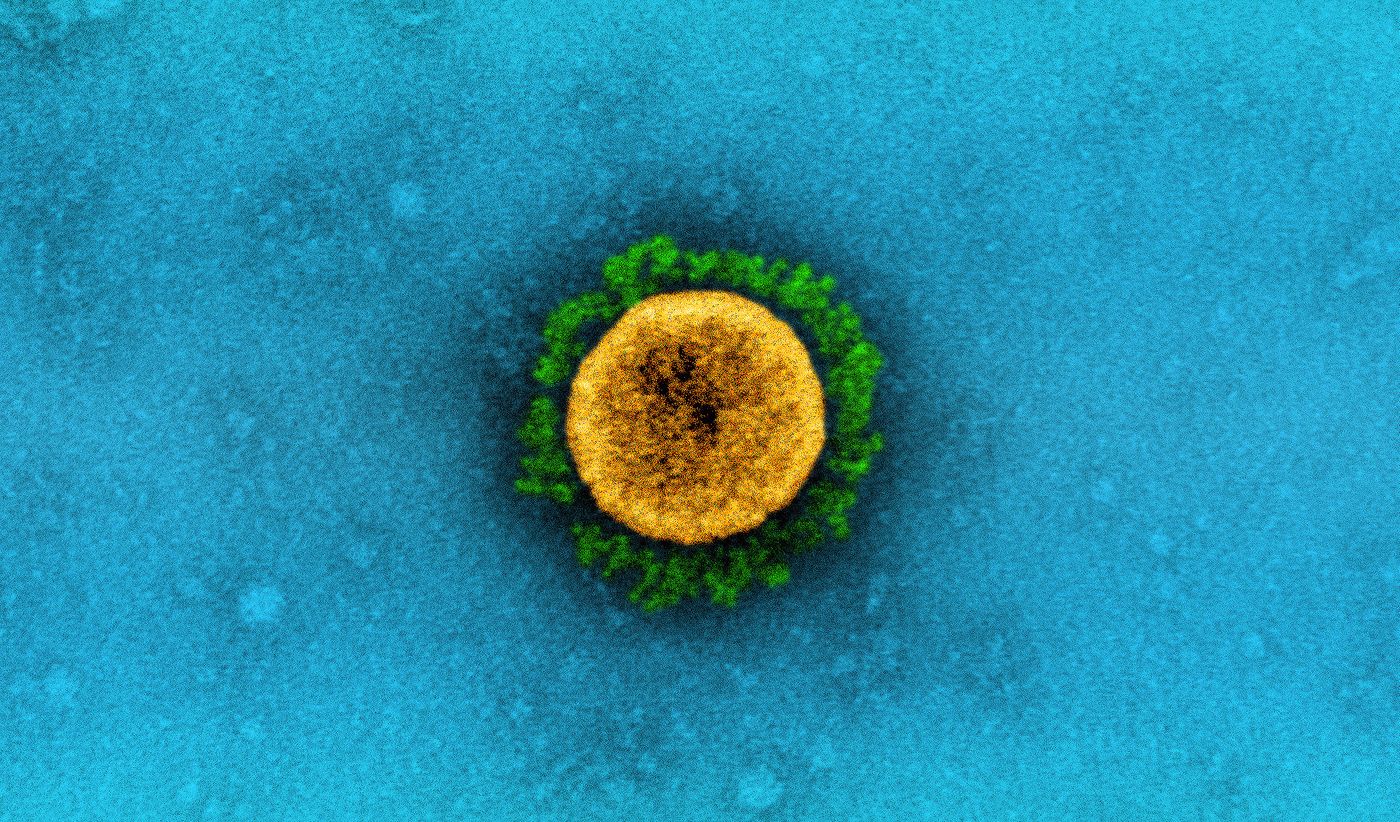 Transmission electron micrograph of a B.1.1.7 variant SARS-CoV-2 virus particle isolated from a patient sample and grown in cell culture. The projections (green) on the outside of the virus particle (yellow) are spike proteins. / Credit: NIAID Integrated Research Facility (IRF) in fort Detrick, Maryland. / NIAID