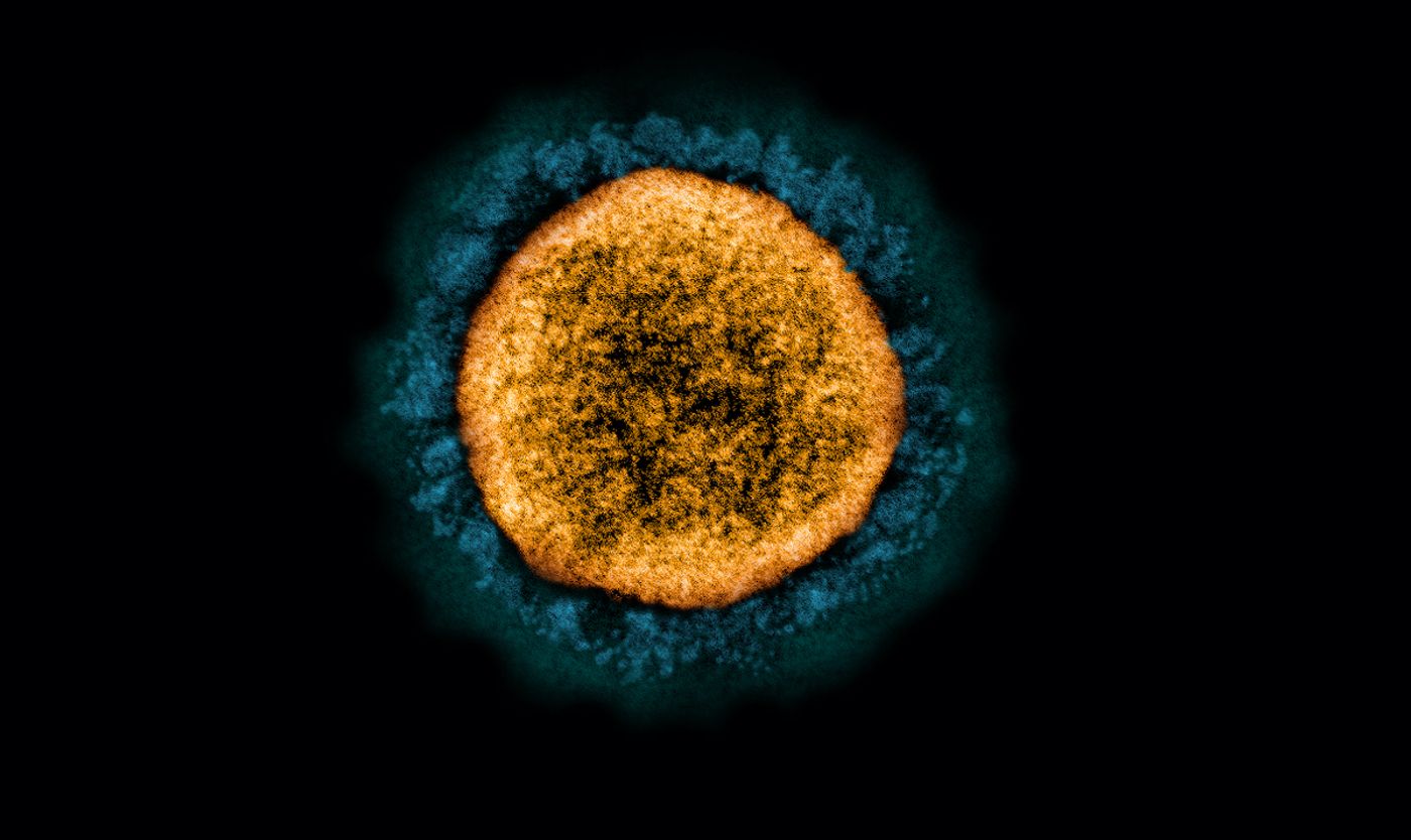 Transmission electron micrograph of a SARS-CoV-2 virus particle (UK B.1.1.7 variant), isolated from a patient sample and cultivated in cell culture. Image captured at the NIAID Integrated Research Facility (IRF) in Fort Detrick, Maryland. Credit: NIAID