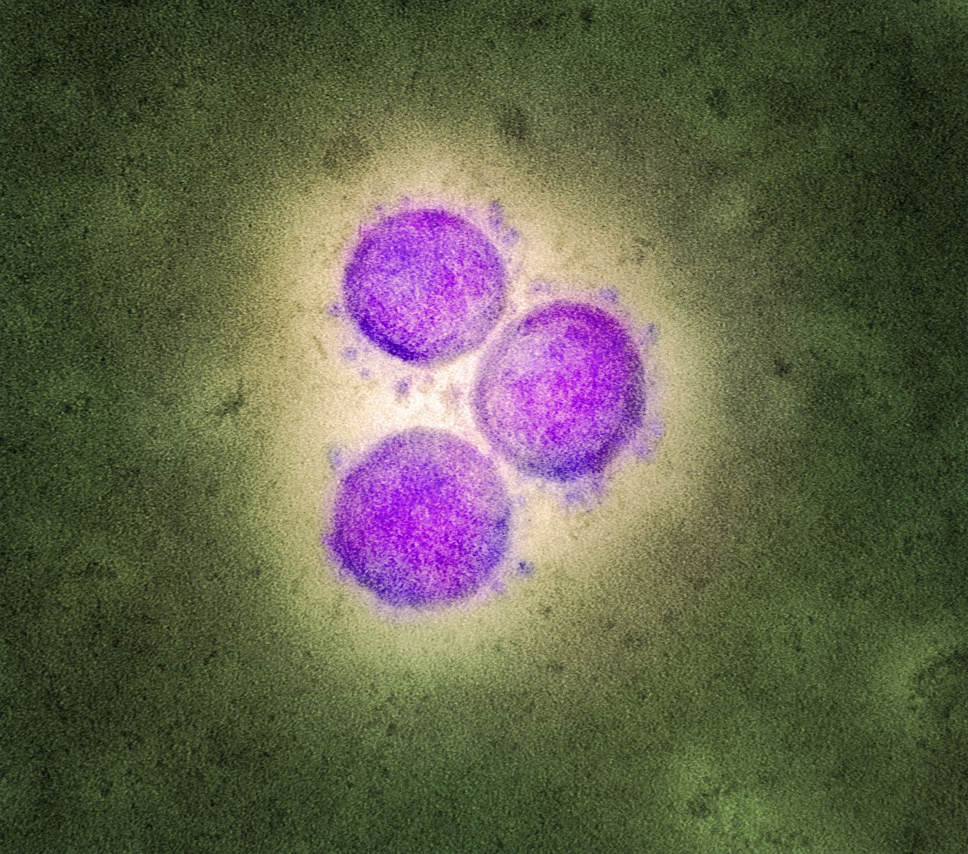 Transmission electron micrograph of SARS-CoV-2 virus particles (UK B.1.1.7 variant), isolated from a patient sample and cultivated in cell culture. Image captured at the NIAID Integrated Research Facility (IRF) in Fort Detrick, Maryland. / Credit: NIAID