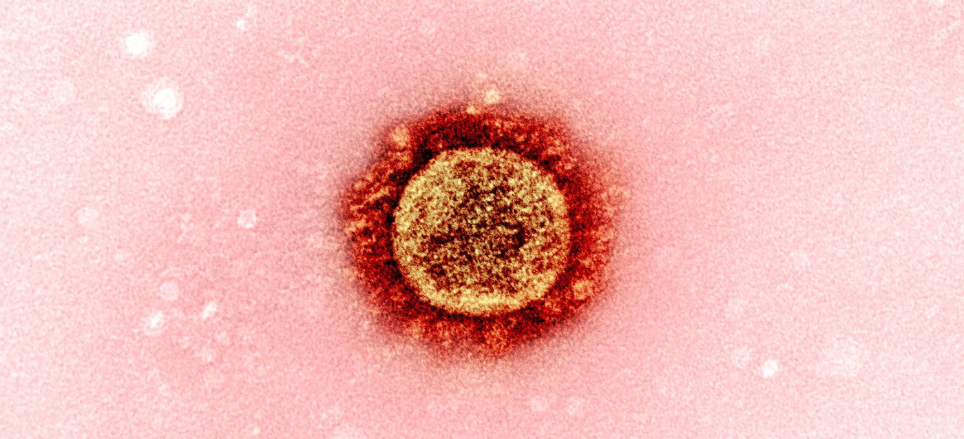 Transmission electron micrograph of a SARS-CoV-2 virus particle (Alpha variant), isolated from a patient sample and cultivated in cell culture. Image captured at the NIAID Integrated Research Facility (IRF) in Fort Detrick, Maryland. Credit: NIAID