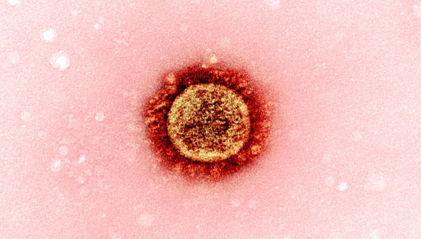   Transmission electron micrograph of a SARS-CoV-2 virus particle (UK B.1.1.7 variant), isolated from a patient sample and cultivated in cell culture. Image captured at the NIAID Integrated Research Facility (IRF) in Fort Detrick, Maryland. / Credit: NIAID   