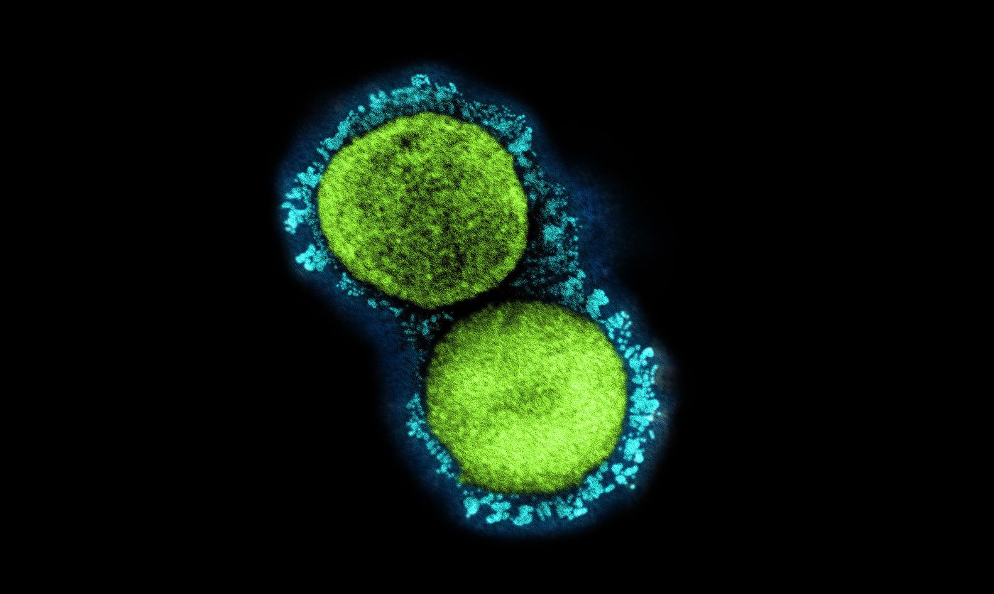 Transmission electron micrograph of SARS-CoV-2 virus particles (UK B.1.1.7 variant), isolated from a patient sample and cultivated in cell culture. Image captured at the NIAID Integrated Research Facility (IRF) in Fort Detrick, Maryland. Credit: NIAID