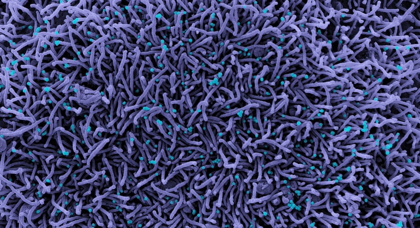 A CCL-81 cell (purple) infected with SARS-CoV-2 virus particles, which are the small spherical structures (teal). The string-like protrusions extending from the cell are cell projections or pseudopodium, whose primary purposes are cell mobility and ingestion of nutrients. Image captured at the NIAID Integrated Research Facility (IRF) in Fort Detrick, Maryland. / Credit: NIAID