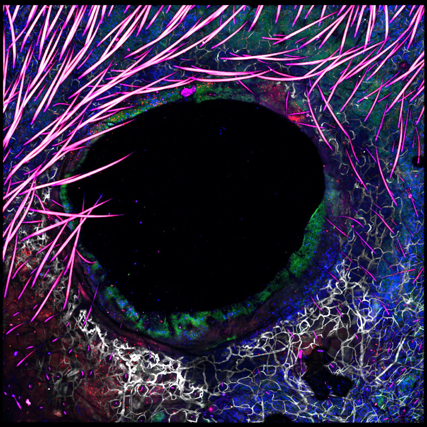 	 NIAID CD8 T Cells Close to Wound After Staphylococcus Epidermidis Application  T cells localize to sites of injury in skin following commensal colonization. Image credit: NIAID