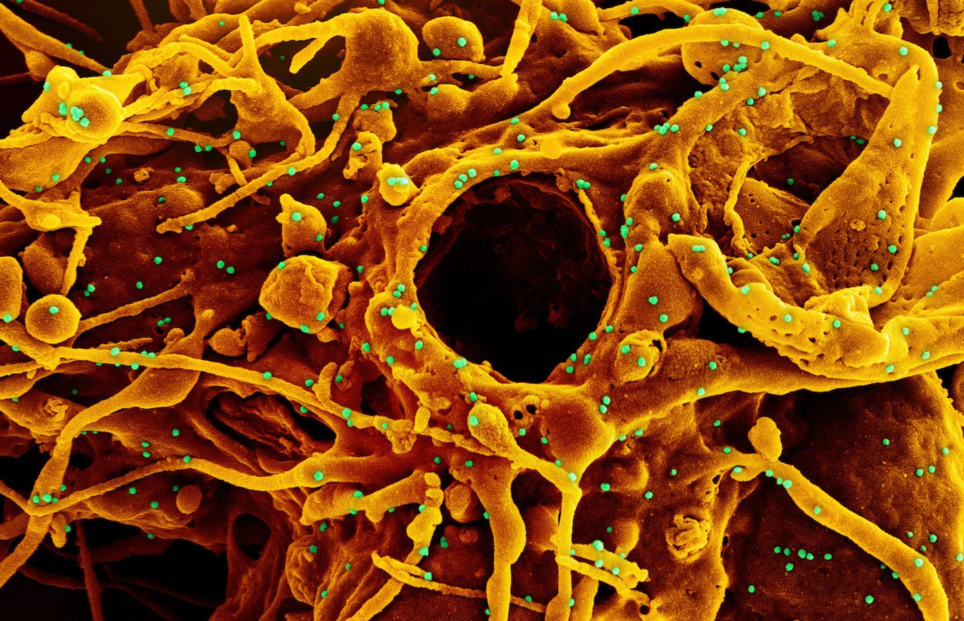 Colorized scanning electron micrograph of a cell (orange) infected with UK B.1.1.7 variant SARS-CoV-2 virus particles (green), isolated from a patient sample. Image captured at the NIAID Integrated Research Facility (IRF) in Fort Detrick, Maryland. Credit: NIAID