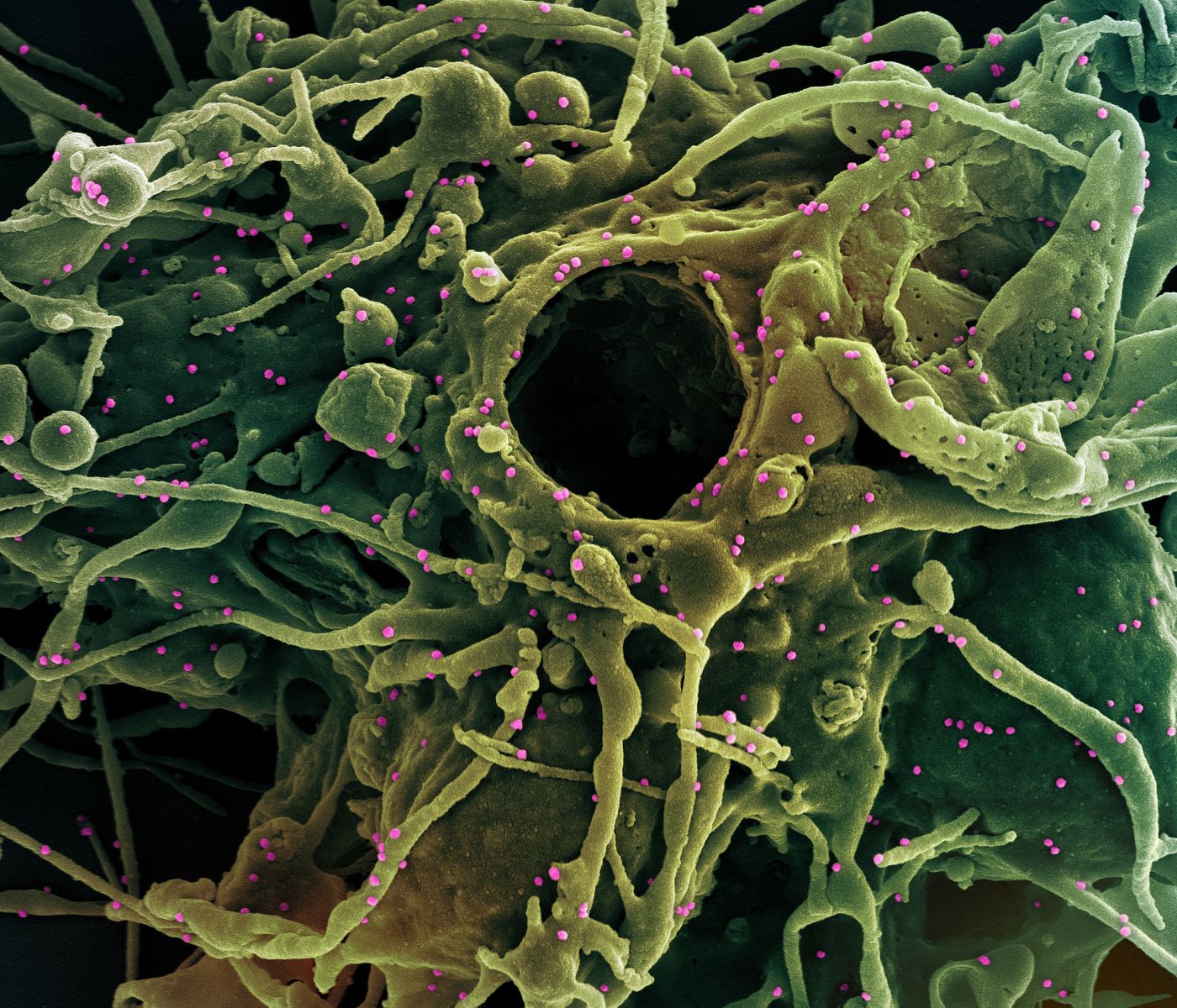 Colorized scanning electron micrograph of a cell (green) infected with a variant of SARS-CoV-2 virus particles (pink), isolated from a patient sample. Image captured at the NIAID Integrated Research Facility (IRF) in Fort Detrick, Maryland. Credit: NIAID