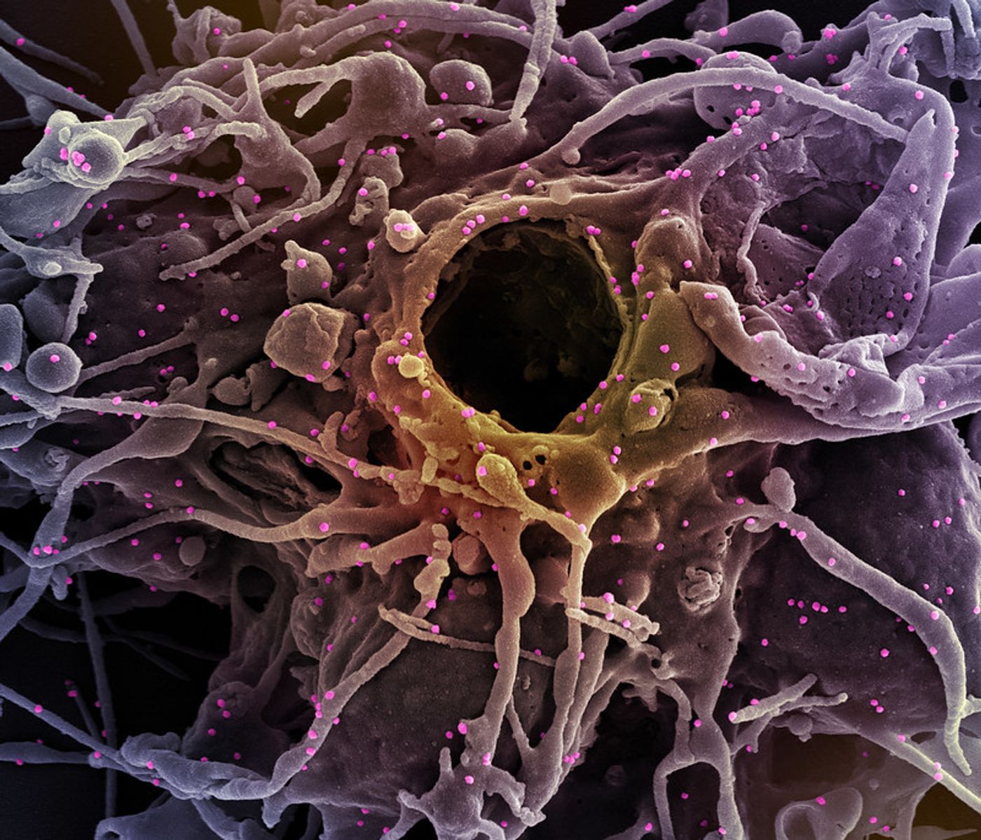 Colorized scanning electron micrograph of a cell (purple) infected with UK B.1.1.7 variant SARS-CoV-2 virus particles (pink), isolated from a patient sample. Image captured at the NIAID Integrated Research Facility (IRF) in Fort Detrick, Maryland. Credit: NIAID