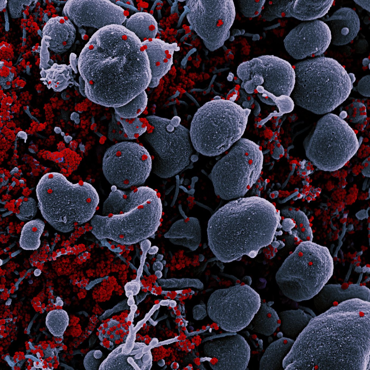 Colorized scanning electron micrograph of an apoptotic cell (gray) heavily infected with SARS-CoV-2 virus particles (red), isolated from a patient sample. Image captured at the NIAID Integrated Research Facility (IRF) in Fort Detrick, Maryland. / Credit: NIAID