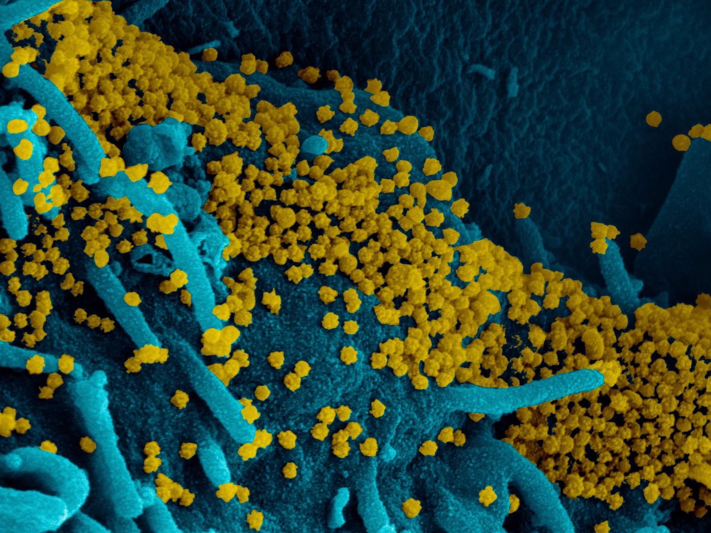 This scanning electron microscope image shows SARS-CoV-2 (round gold particles) emerging from the surface of a cell cultured in the lab. Image captured and colorized at Rocky Mountain Laboratories in Hamilton, Montana. / Credit: NIAID