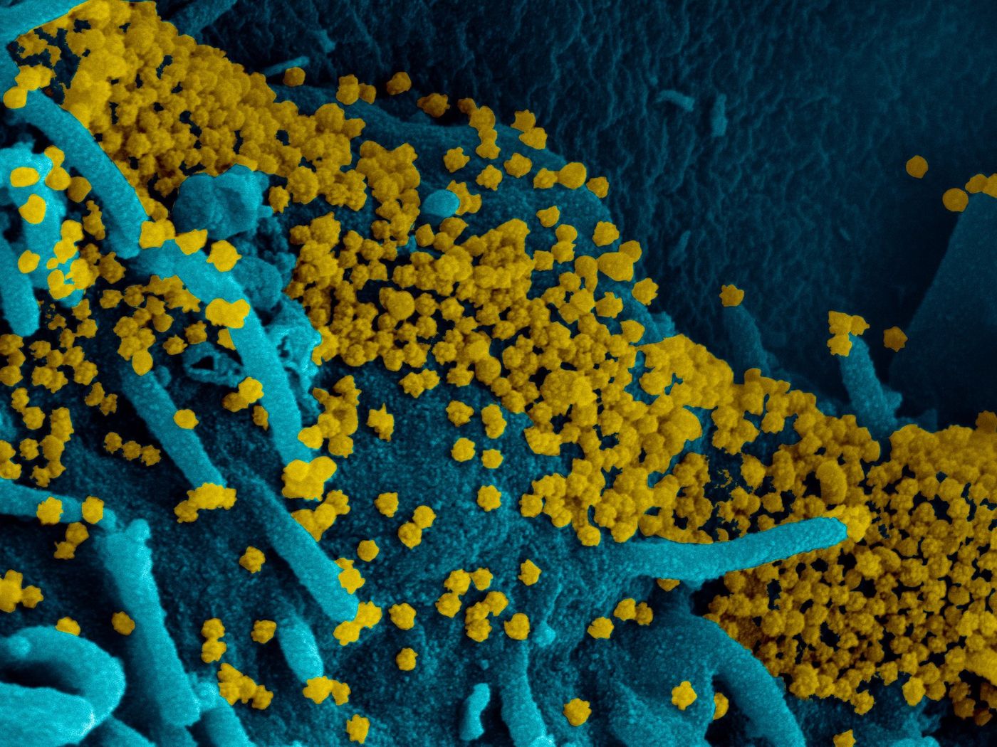 This scanning electron microscope image shows SARS-CoV-2 (round gold particles) emerging from the surface of a cell cultured in the lab. SARS-CoV-2, also known as 2019-nCoV, is the virus that causes COVID-19. Image captured and colorized at Rocky Mountain Laboratories in Hamilton, Montana./  Credit: NIAID