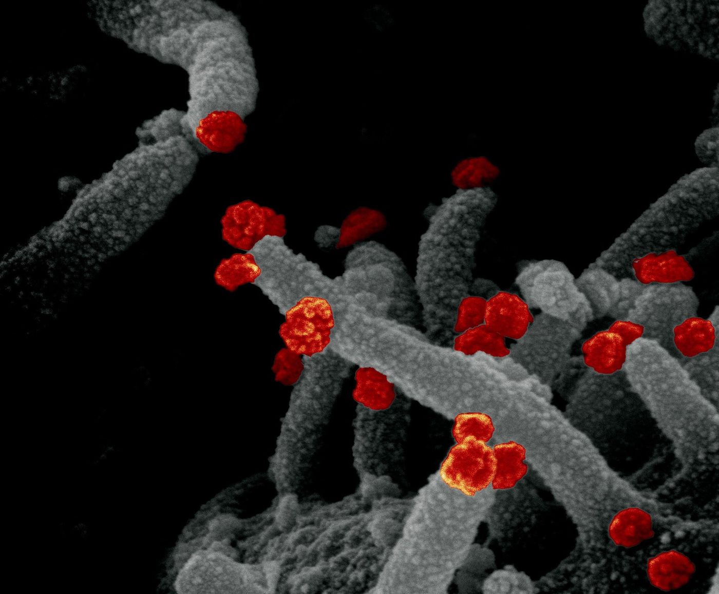 This scanning electron microscope image shows SARS-CoV-2 (round red particles) emerging from the surface of a cell cultured in the lab. SARS-CoV-2, also known as 2019-nCoV, is the virus that causes COVID-19. Image captured and colorized at Rocky Mountain Laboratories in Hamilton, Montana. / Credit: NIAID