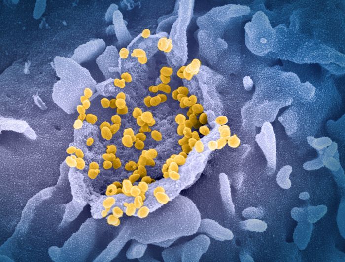 This scanning electron microscope image shows SARS-CoV-2 (round gold particles) emerging from the surface of a cell cultured in the lab. SARS-CoV-2, also known as 2019-nCoV, is the virus that causes COVID-19. Image captured and colorized at Rocky Mountain Laboratories in Hamilton, Montana. Credit: NIAID