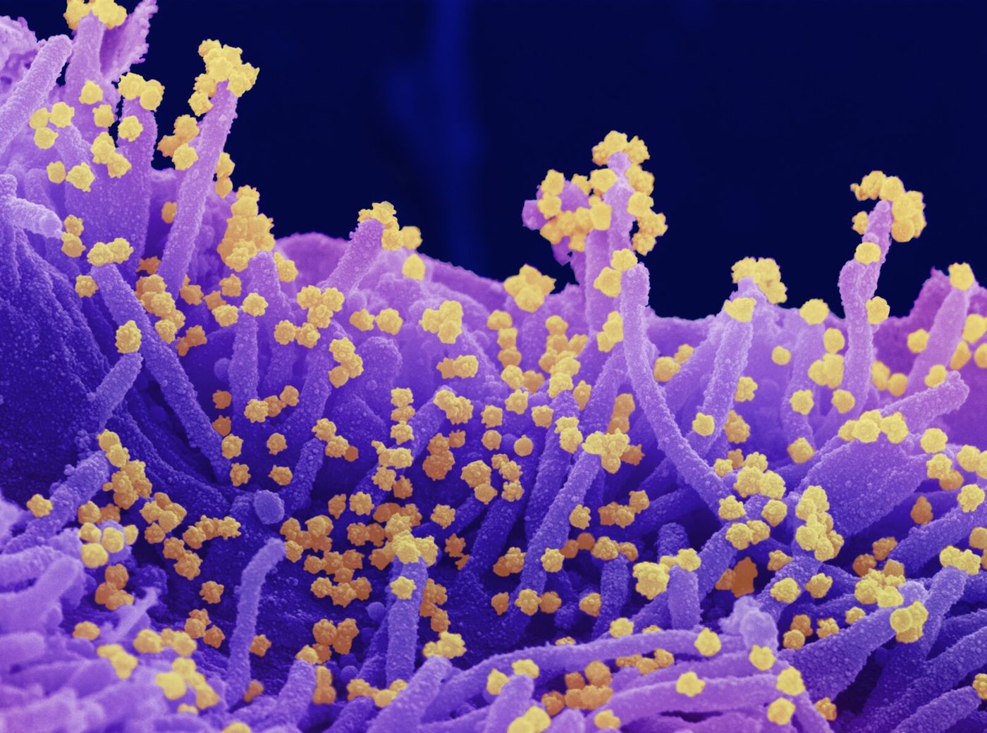 An SEM image of SARS-CoV-2 (round gold particles) emerging from the surface of a cell cultured in the lab. Image captured and colorized at Rocky Mountain Laboratories in Hamilton, Montana. / Credit: NIAID