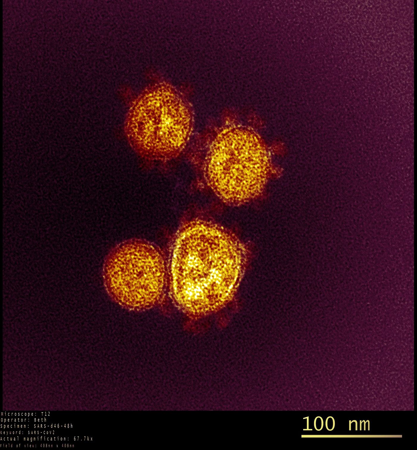 This transmission electron microscope image shows SARS-CoV-2-also known as 2019-nCoV, the virus that causes COVID-19. Virus particles are shown emerging from the surface of a cell cultured in the lab. The spikes on the outer edge of the virus particles give coronaviruses their name, crown-like. Image captured and colorized at Rocky Mountain Laboratories in Hamilton, Montana. Credit: NIAID