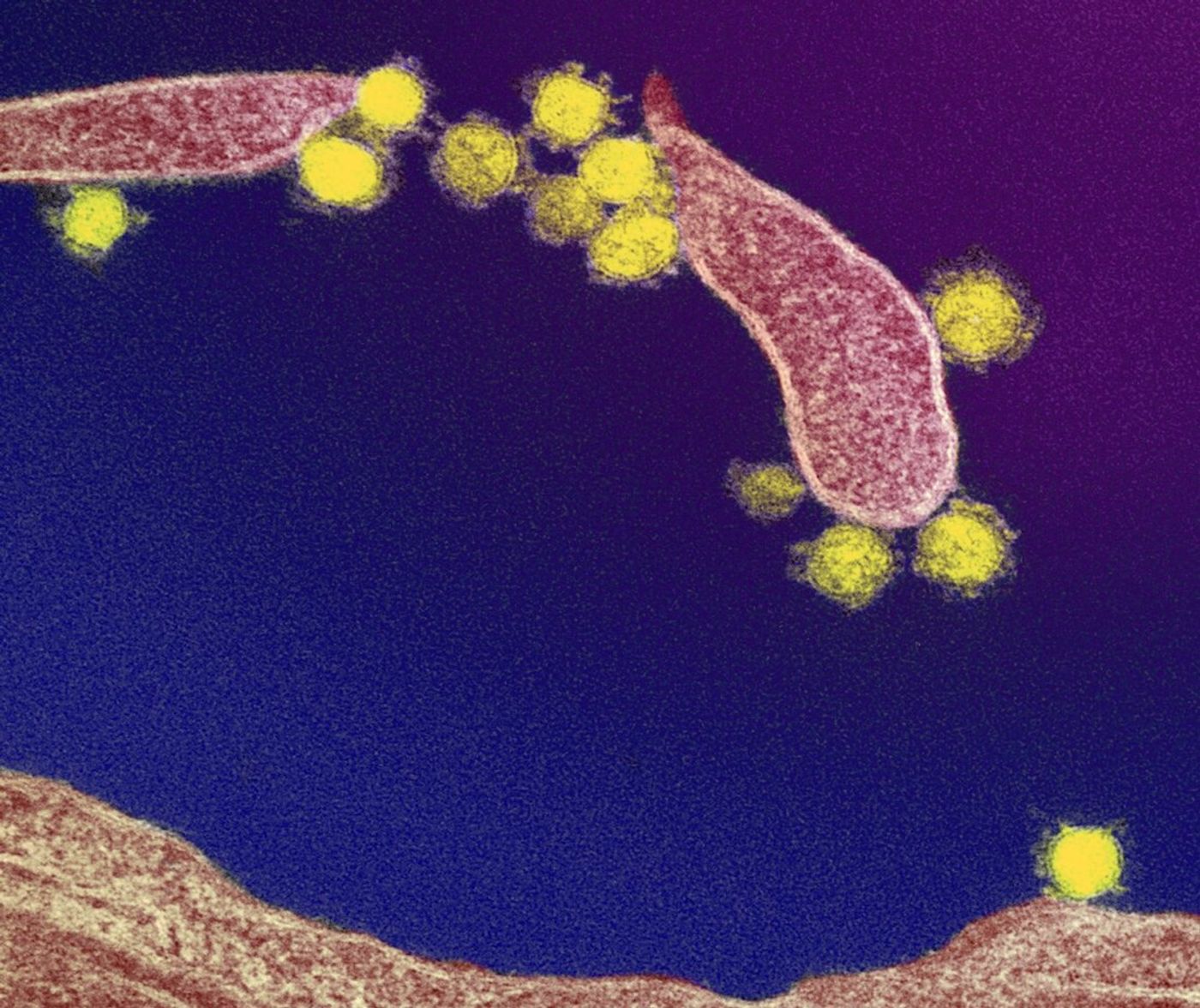 This transmission electron microscope image shows SARS-CoV-2, the virus that causes COVID-19. Virus particles are shown emerging from the surface of a cell cultured in the lab. The spikes on the outer edge of the virus particles give coronaviruses their name, crown-like. Image captured and colorized at Rocky Mountain Laboratories in Hamilton, Montana. / Credit: NIAID
