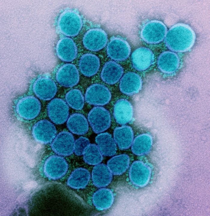 Transmission electron micrograph of a variant strain of SARS-CoV-2 virus particles (UK B.1.1.7), isolated from a patient sample and cultivated in cell culture. Image captured at the NIAID Integrated Research Facility (IRF) in Fort Detrick, Maryland. / Credit: NIAID