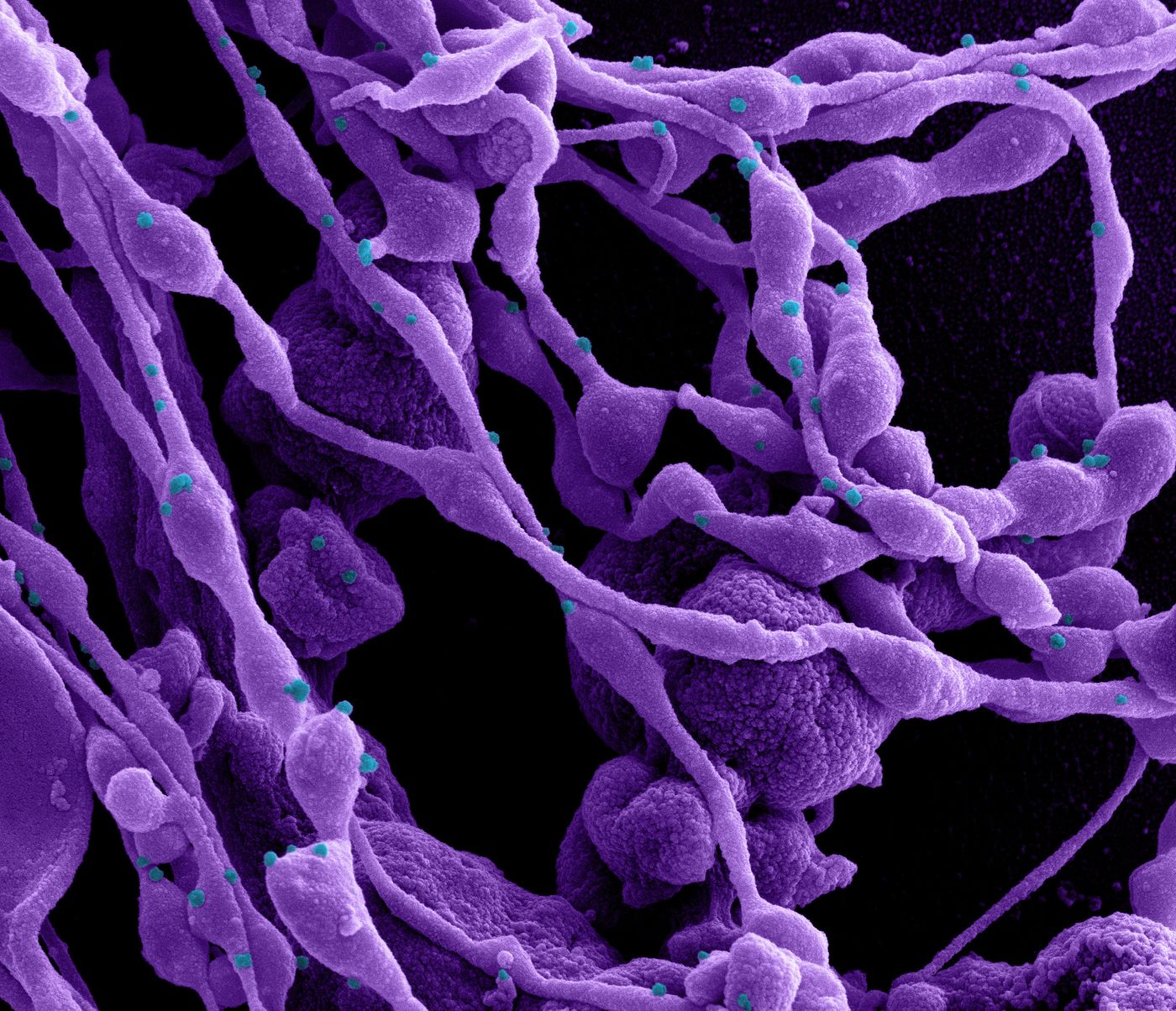 Colorized scanning electron micrograph of a cell (purple) infected with SARS-CoV-2 virus particles (blue), isolated from a patient sample. Image captured at the NIAID Integrated Research Facility (IRF) in Fort Detrick, Maryland. / Credit: Image and caption courtesy NIAID