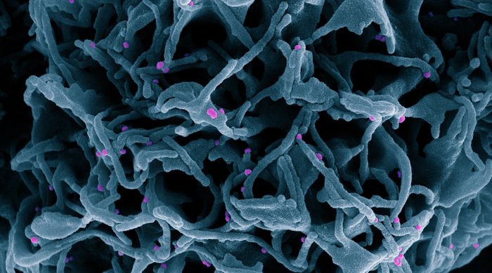 Cropped from a colorized scanning electron micrograph of a cell (blue) infected with SARS-CoV-2 virus particles (pink), isolated from a patient sample. Image captured at the NIAID Integrated Research Facility (IRF) in Fort Detrick, Maryland. / Credit: NIAID
