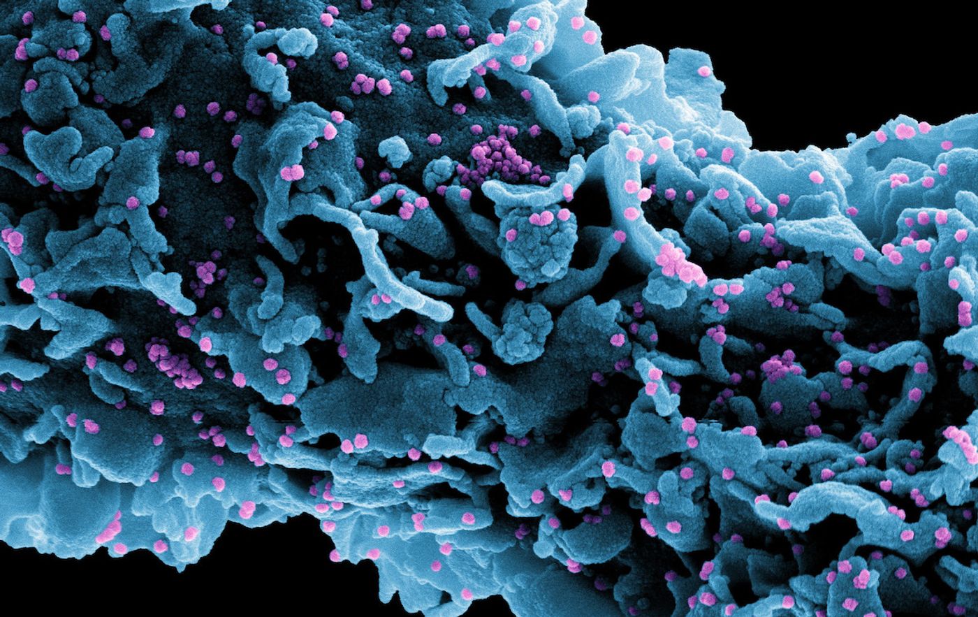 Cropped from a colorized scanning electron micrograph of a cell (blue) infected with a variant strain of SARS-CoV-2 virus particles (UK B.1.1.7; purple), isolated from a patient sample. Image captured at the NIAID Integrated Research Facility (IRF) in Fort Detrick, Maryland. / Credit: NIAID