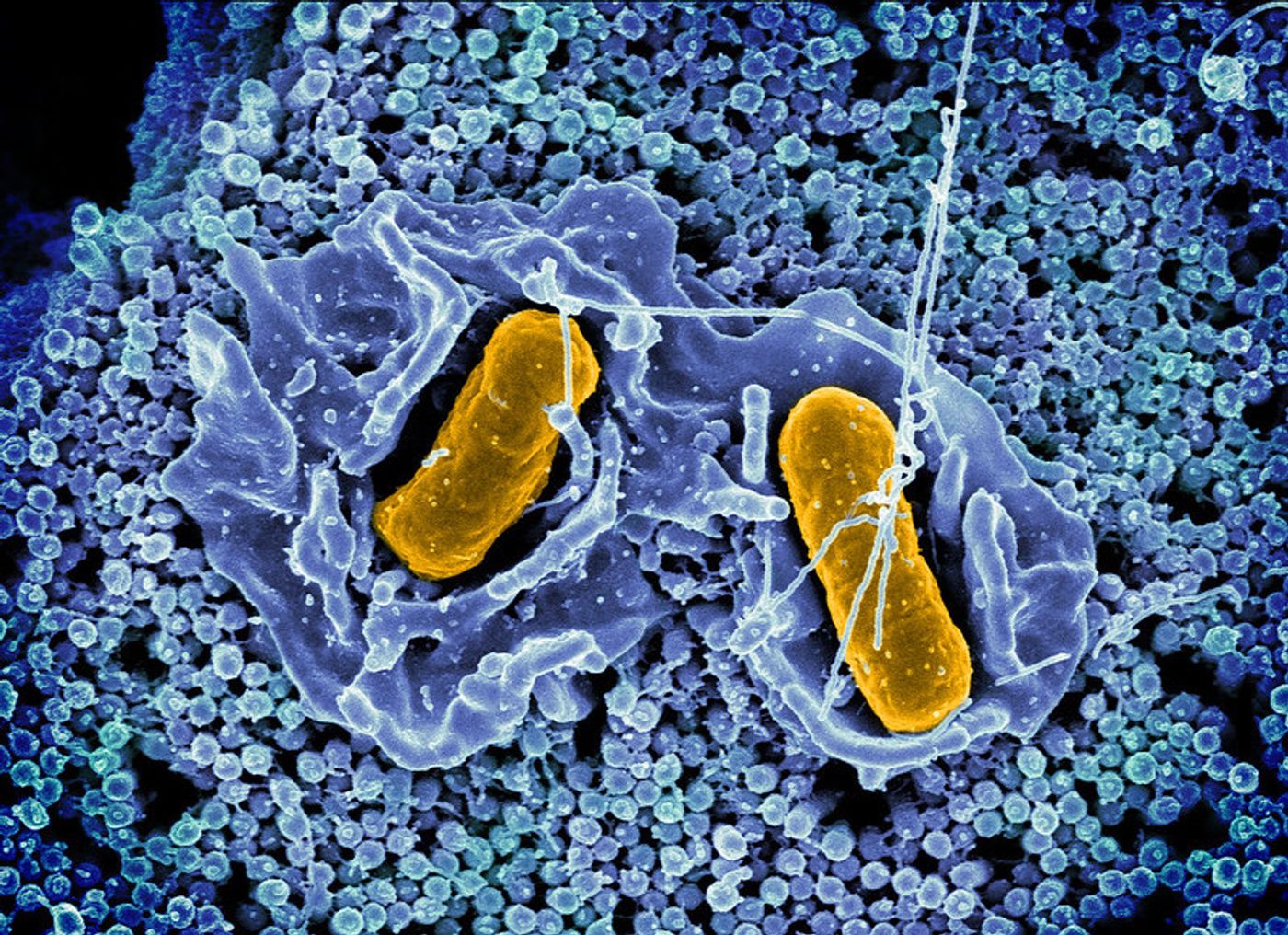 Scanning electron micrograph of Salmonella Typhimurium invading a human epithelial cell. Credit: NIAID