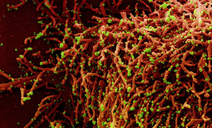 Image credit: Cropped from a colorized scanning electron micrograph of a cell (red) infected with a variant strain of SARS-CoV-2 virus particles (green), isolated from a patient sample. Image captured at the NIAID Integrated Research Facility (IRF) in Fort Detrick, Maryland. Courtesy: NIAID