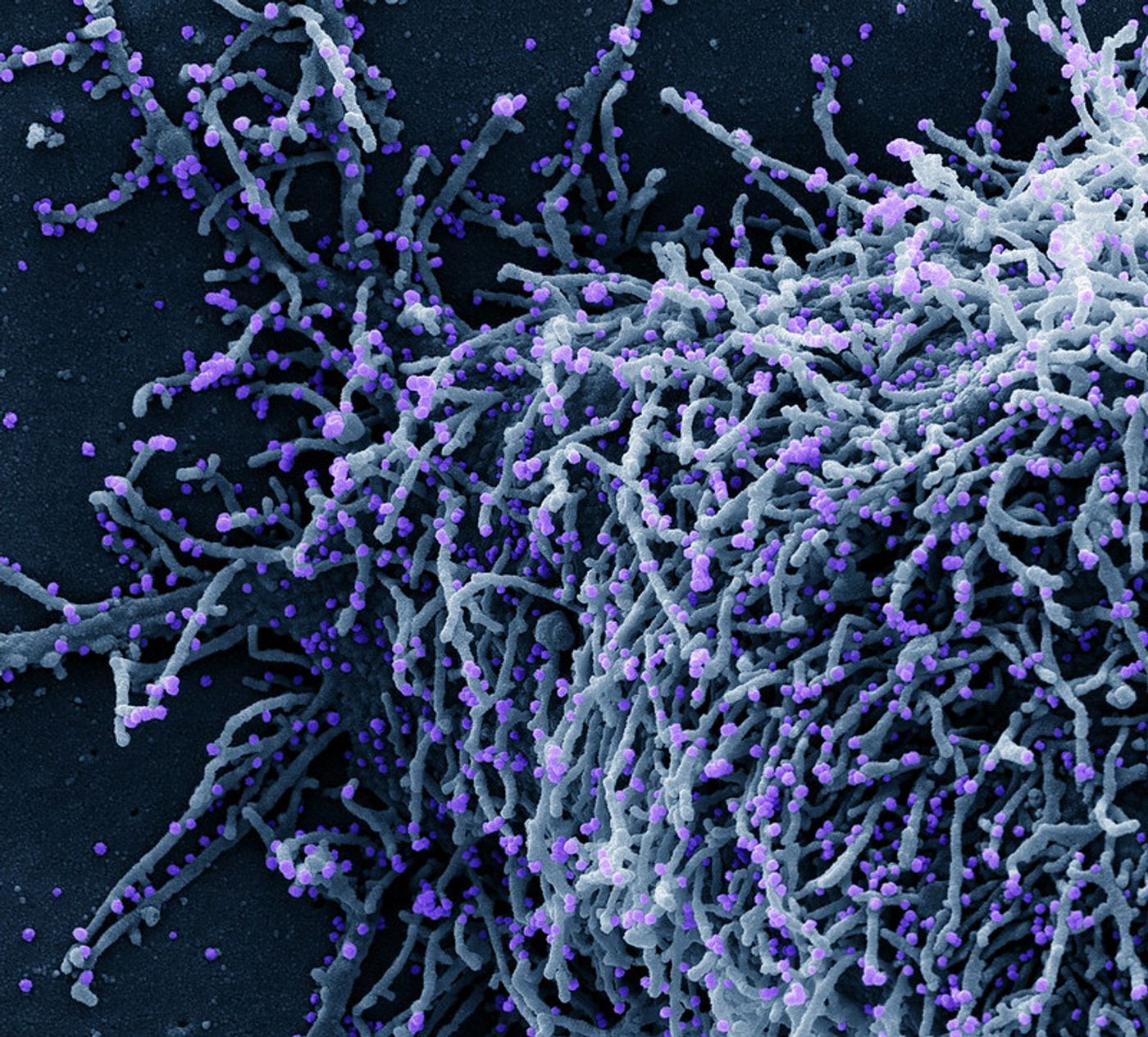 Colorized scanning electron micrograph of a cell (blue) infected with a variant strain of SARS-CoV-2 virus particles (purple), isolated from a patient sample. Image captured at the NIAID Integrated Research Facility (IRF) in Fort Detrick, Maryland. Credit: NIAID