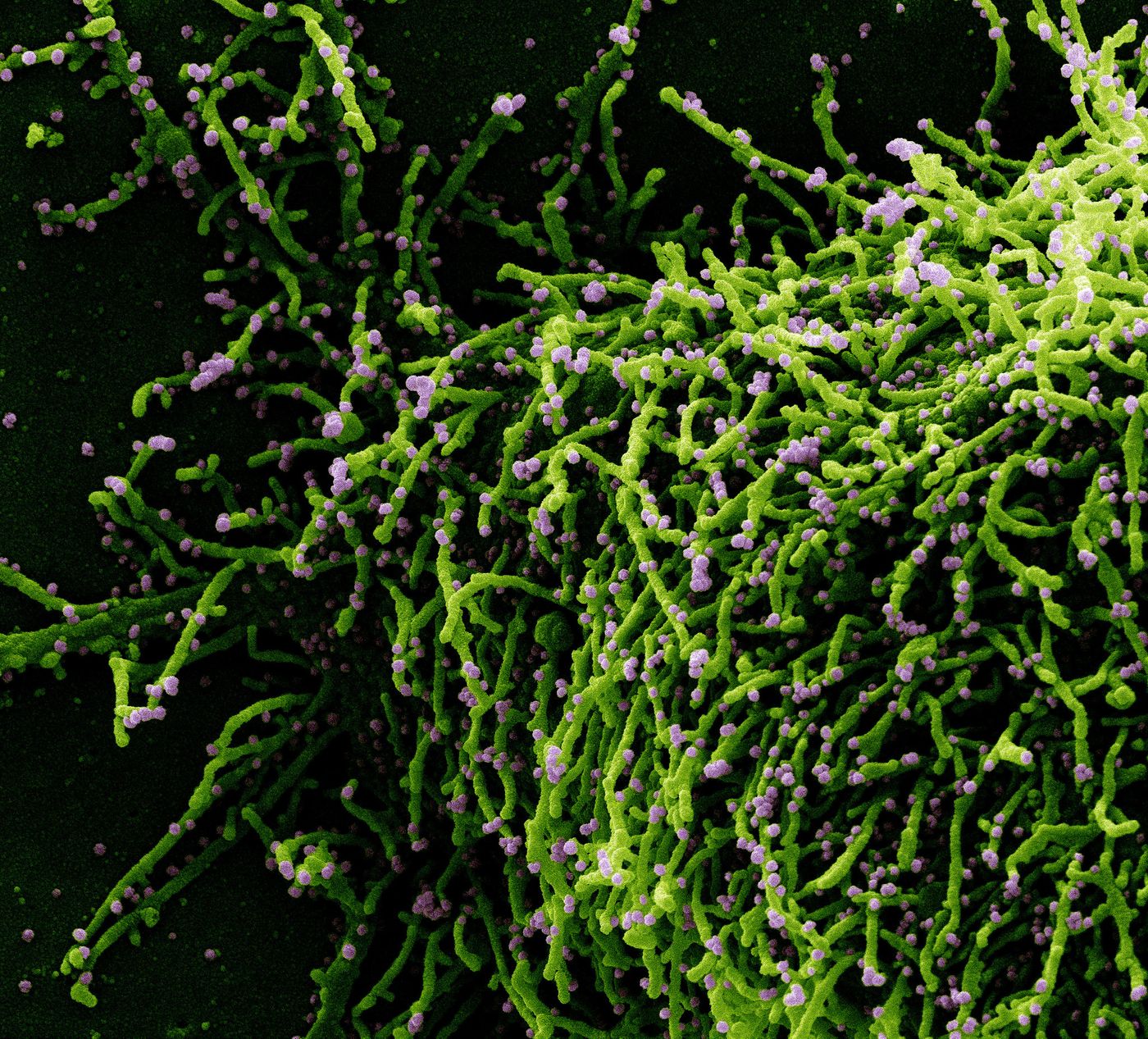 Colorized scanning electron micrograph of a cell (green) infected with a variant strain of SARS-CoV-2 virus particles (purple), isolated from a patient sample. Image captured at the NIAID Integrated Research Facility (IRF) in Fort Detrick, Maryland. Credit: NIAID