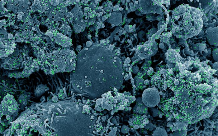 Colorized scanning electron micrograph of chronically infected and partially lysed cells (blue) infected with a variant strain of SARS-CoV-2 virus particles (green), isolated from a patient sample. Image captured at the NIAID Integrated Research Facility (IRF) in Fort Detrick, Maryland. / Credit: NIAID