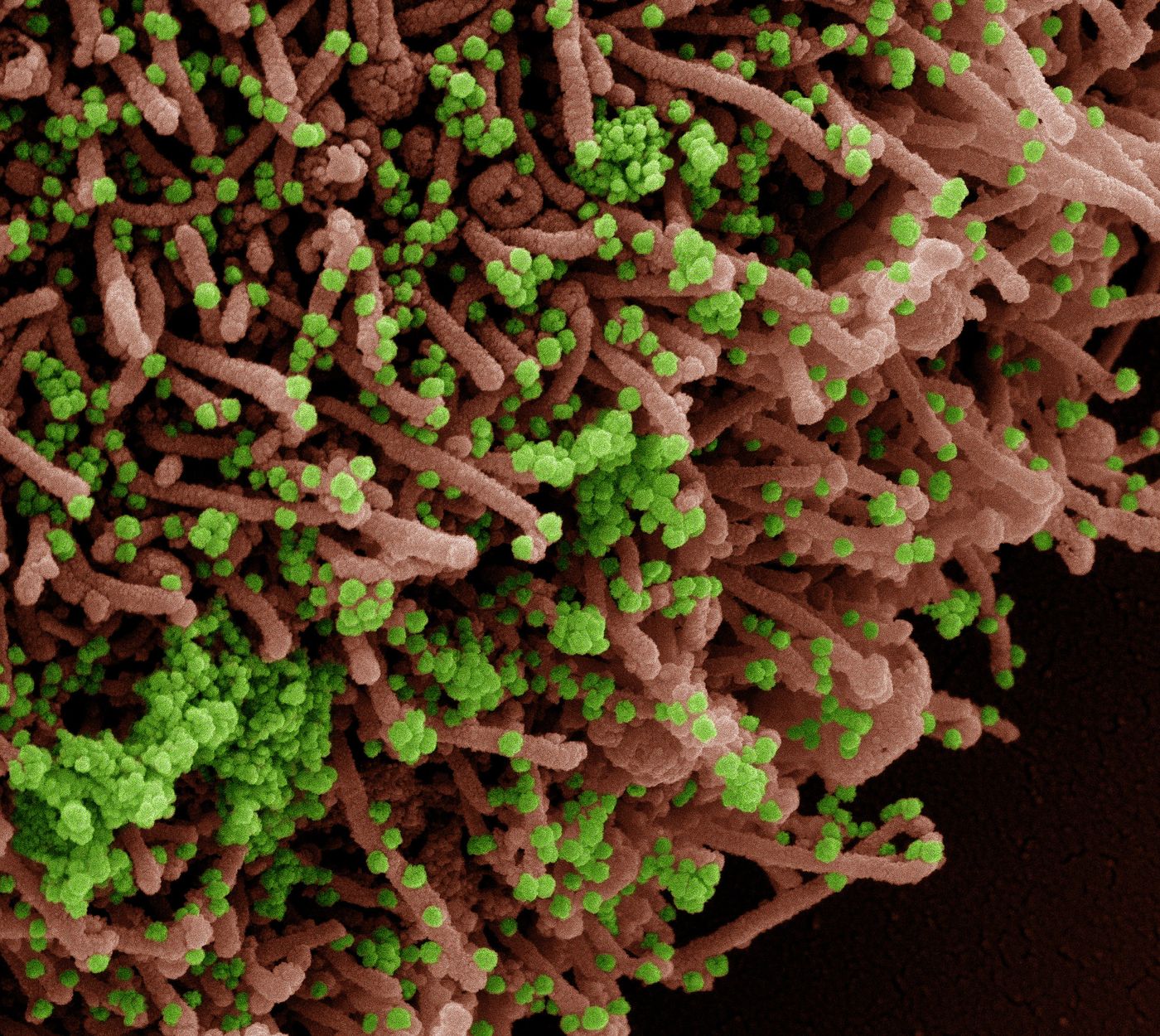 Colorized scanning electron micrograph of a cell (red) infected with a variant strain of SARS-CoV-2 virus particles (green), isolated from a patient sample. Image captured at the NIAID Integrated Research Facility (IRF) in Fort Detrick, Maryland. Credit: NIAID