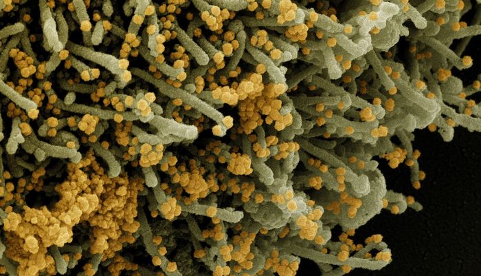 Colorized scanning electron micrograph of a cell (olive green) infected with a variant strain of SARS-CoV-2 virus particles (orange), isolated from a patient sample. Image captured at the NIAID Integrated Research Facility (IRF) in Fort Detrick, Maryland. Credit: NIAID