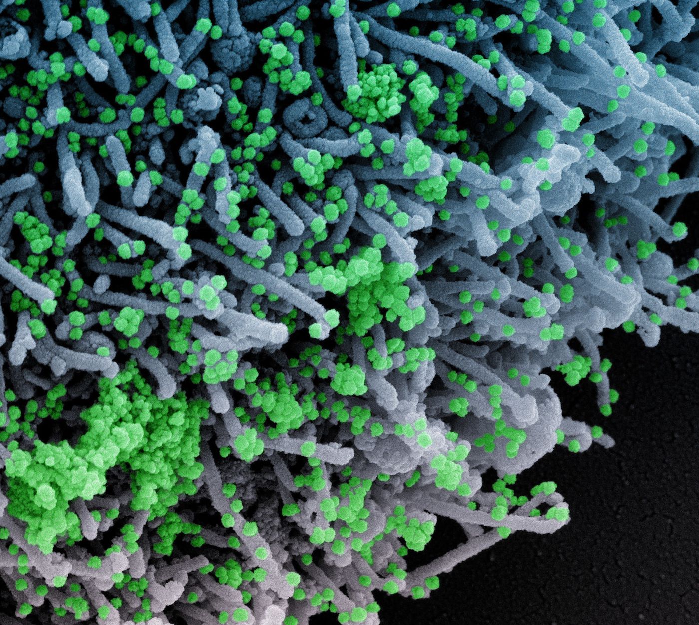 Colorized scanning electron micrograph of a cell (blue) infected with a variant strain of SARS-CoV-2 virus particles (green), isolated from a patient sample. Image captured at the NIAID Integrated Research Facility (IRF) in Fort Detrick, Maryland. Credit: NIAID