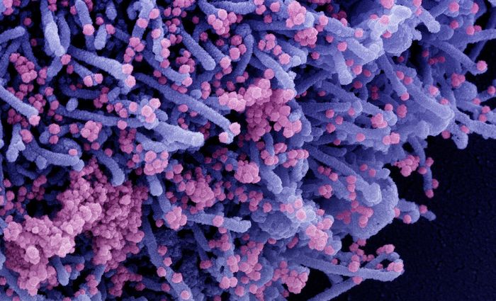 [Cropped from] Colorized scanning electron micrograph of a cell (purple) infected with a variant strain of SARS-CoV-2 virus particles (pink), isolated from a patient sample. Image captured at the NIAID Integrated Research Facility (IRF) in Fort Detrick, Maryland. Credit: NIAID
